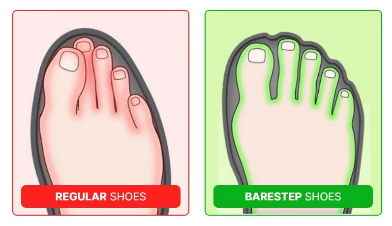 Barestep