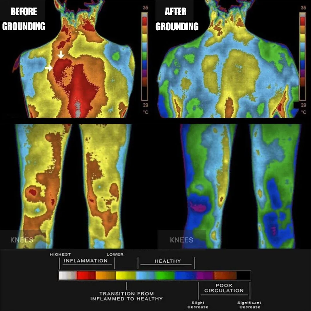 Sleep study thermal imaging comparison